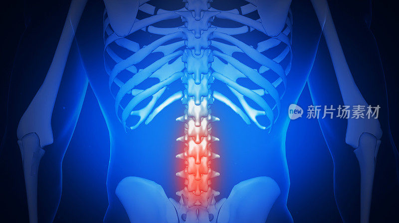 医学上准确的一个男人有一个痛苦的背部。脊髓是人体骨骼解剖学的一部分。痛在脊梁-保健概念。3 d
